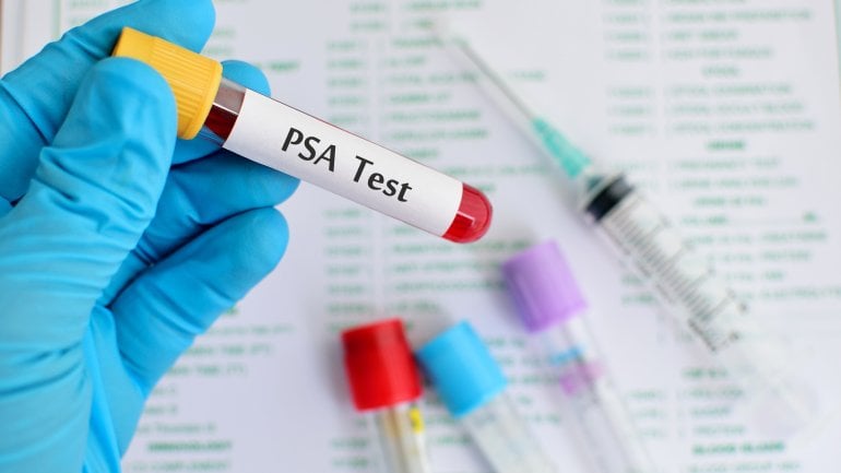 PSA-Wert: Bild einer Blutprobe zum Test.