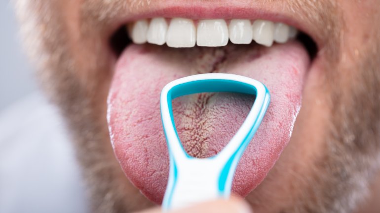 Belegte Zunge: Symptom bei Blinddarmentzündung