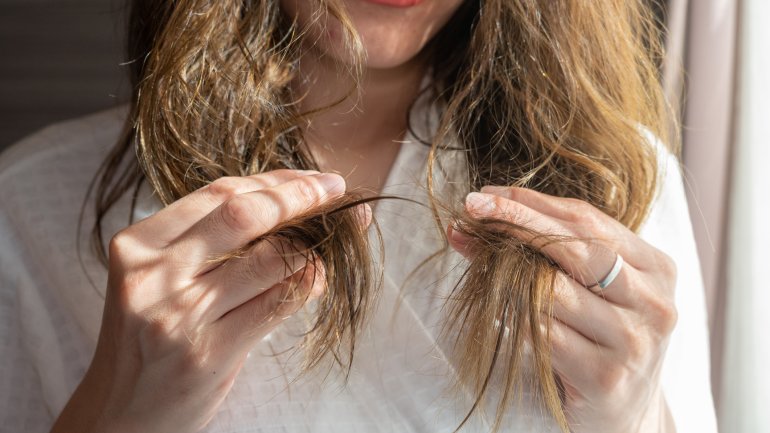 Strohiges Haar als Symptom bei Calciummangel