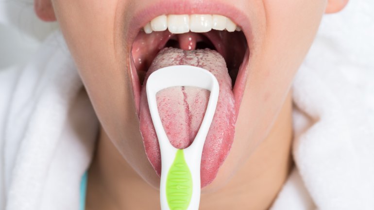Was tun gegen Mundgeruch? Belag auf der Zunge entfernen