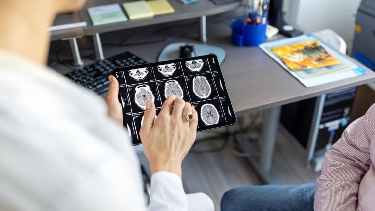 Fachleute untersuchen ein MRT Bild eines Hirntumors.