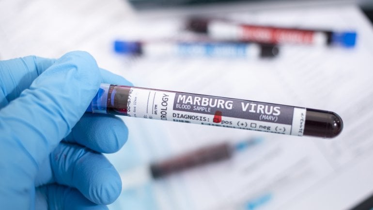Marburgvirus-Test im Labor