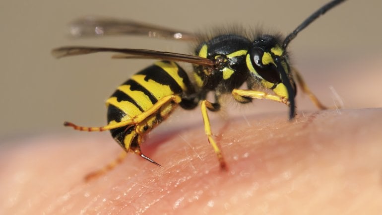Wespe sitzt auf der Haut: Was tun bei einem Wespenstich?