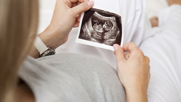 Eine Schwangere mit Ultraschallbild.