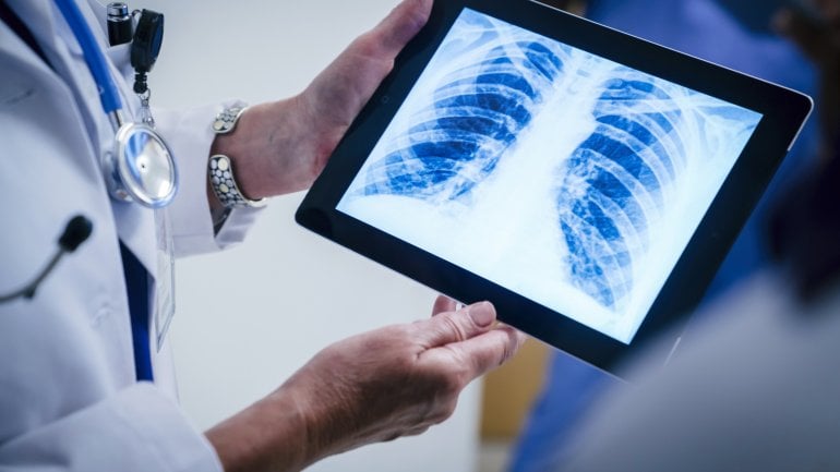 Arzt hält ein Röntgenbild mit Trichterbrust in den Händen.