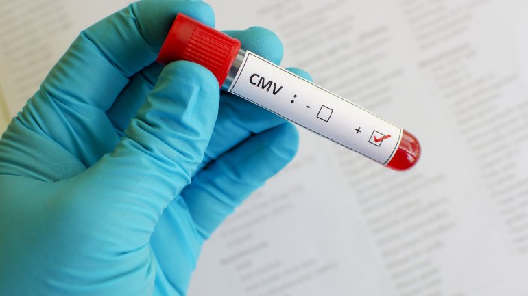 Zytomegalie: Ärztliches Personal hält eine Blutprobe zum Test einer CMV-Infektion in der Hand.