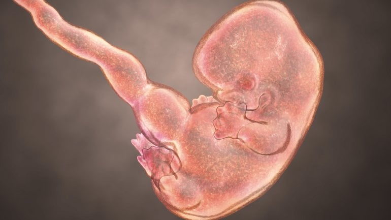 Embryo in der 7 SSW