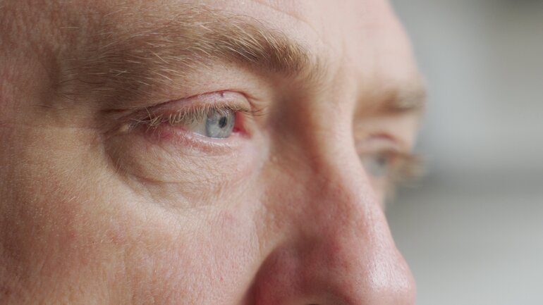 Augenprobleme sind Nebenwirkungen der Abnehmspritze