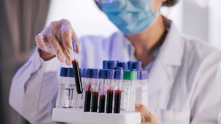 Erhöhter ALT-Wert: Ein mögliches Warnsignal für die Leber