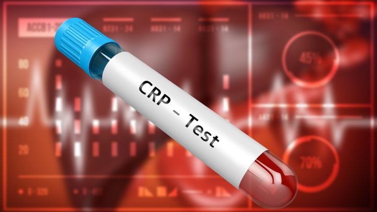 Blutwert: C-reaktives Protein (CRP) erhöht