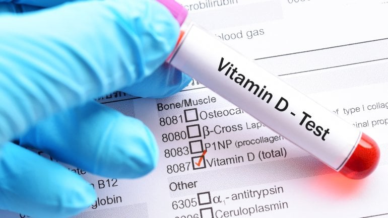 Blutwert: Vitamin D