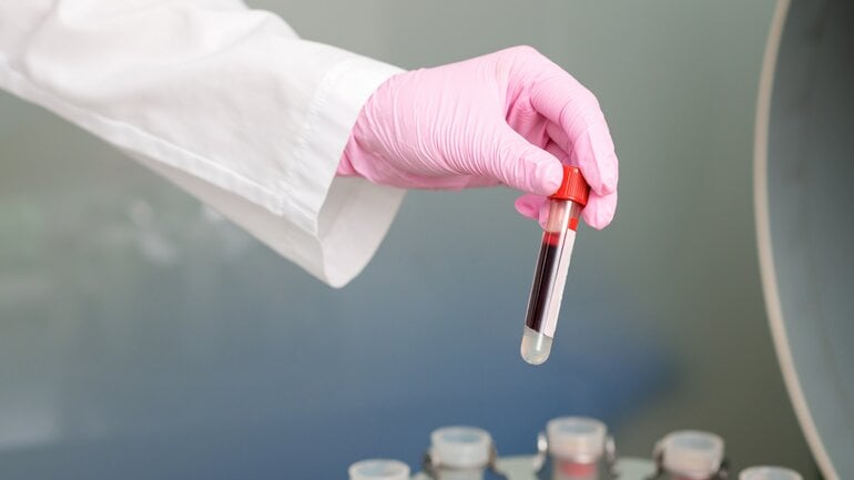 Eine Blutprobe im Röhrchen wird im Labor in die Zentrifuge gegeben. 