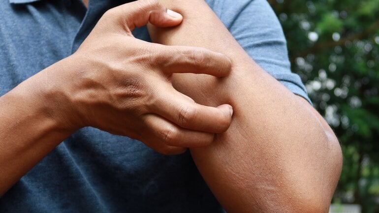 Leberentzündung (Hepatitis) ist eine häufige Lebererkrankung