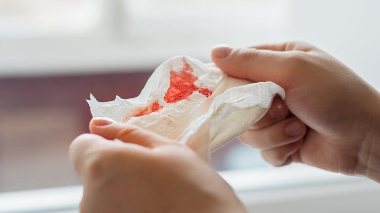 Lippenkrebs: Blutende Wunden sind weitere mögliche Symptome