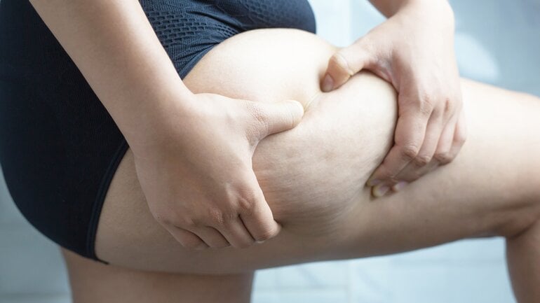 Fibrosarkom: Tumor aus Bindegewebe