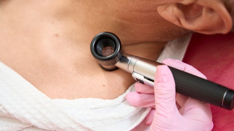 Angiosarkom: Tumor der Blut- oder Lymphgefäße