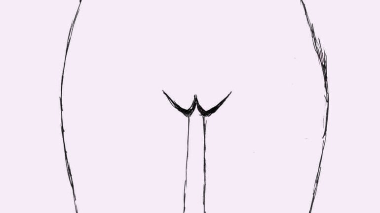 Typ 1: &quot;Geschlossene&quot; Vulva