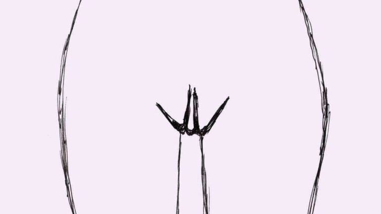 Typ 5: Ausgeprägte innere Labien (&quot;petal-like&quot;)