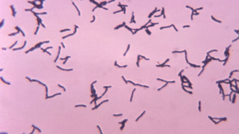 Mikroskopische Aufnahme von Bakterien der Art Actinomyces eriksonii.