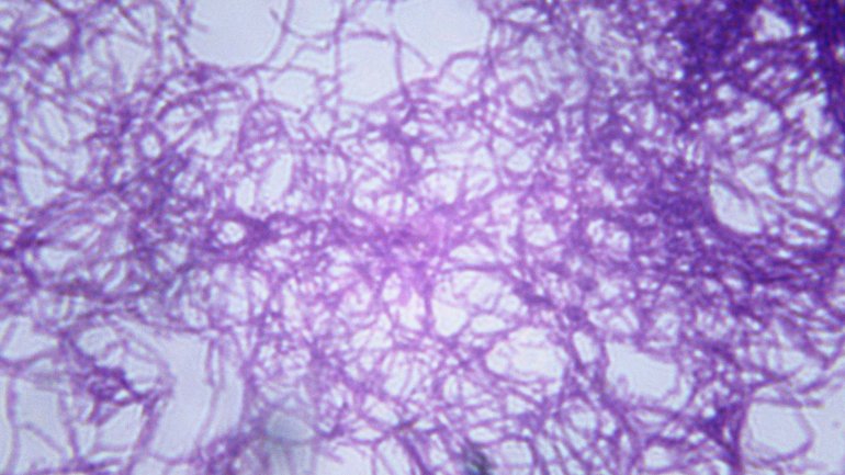 Das Bild zeigt das Bakterium Bacillus anthracis.