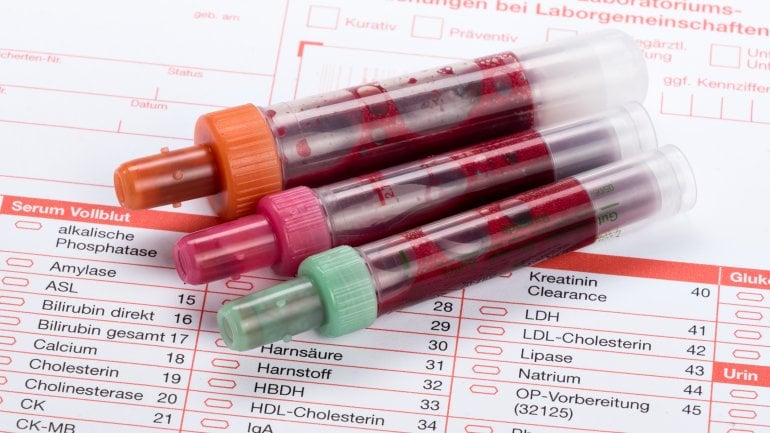 Bilirubin-Wert: Bild von mehreren Blutproben auf einem ärztlichen Dokument.