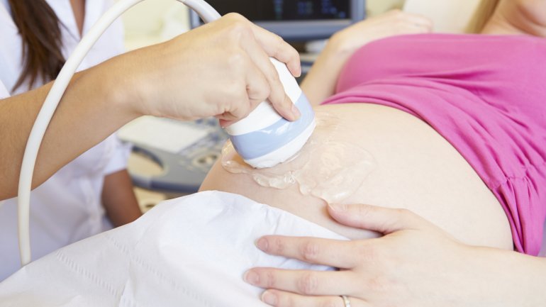 Ultraschall bei einer Schwangeren.
