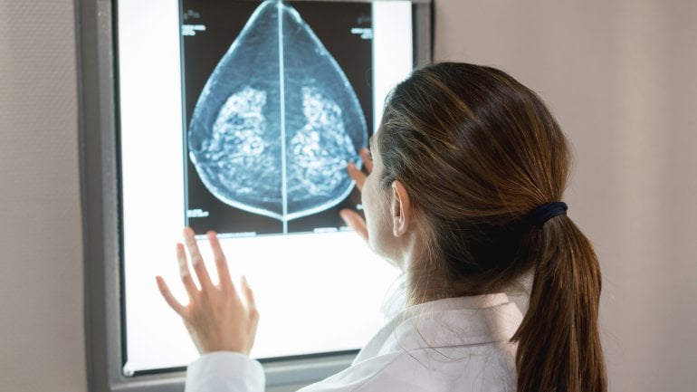 Brustkrebs frühzeitig erkennen: Mammographie-Screening