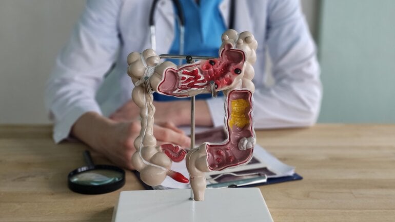 Zu sehen ist ein Arzt, vor ihm steht ein Modell eines Darms