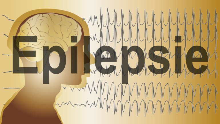 Man sieht die schematische Darstellung eines Schädel, den Schriftzug Epilepsie und im Hintergrund den Ausschlag eines EEGs.