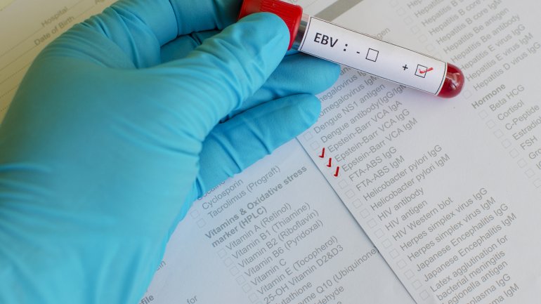 Epstein Barr Virus Blutwerte Erhöht www.onmeda.de