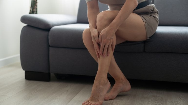 Erythema nodosum: Junge Frau tastet ihre Beine ab