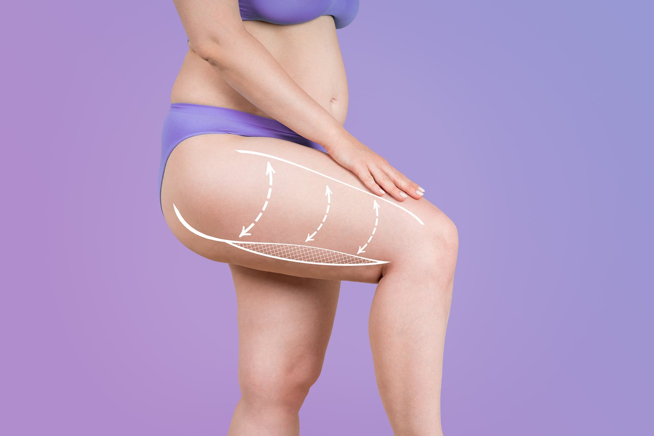 vibrations liposuktion Nouvag: Schweizer Präzision für medizinische und ästhetische Geräte main image 1