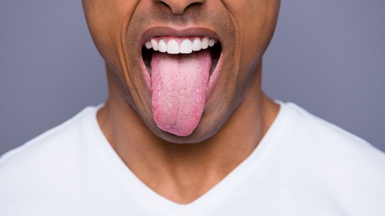 Folsäuremangel: Zungenbrennen ist ein Symptom