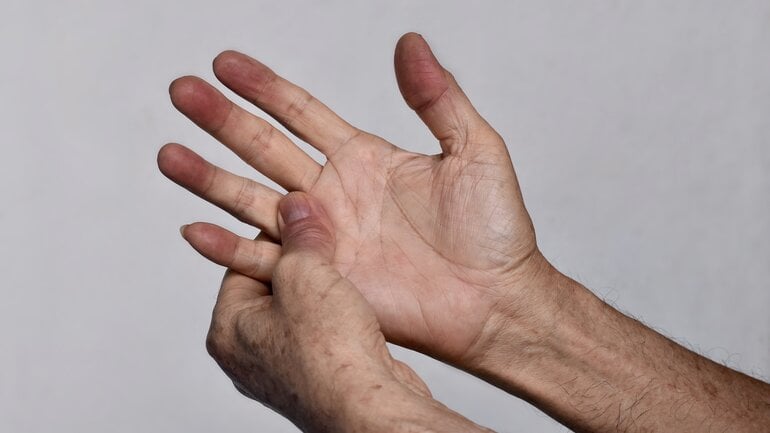 ARDS: Sauerstoffmangel ist Symptom bei Lungenversagen