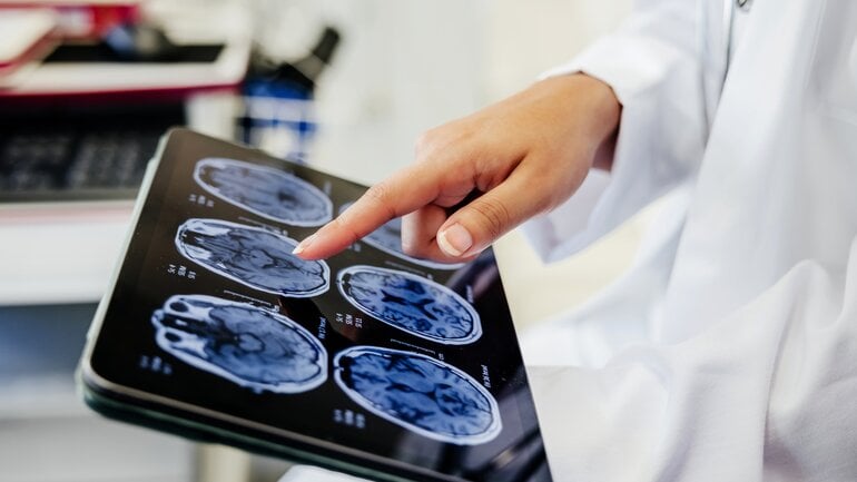 Ursache von ALS: Welche Rolle spielen Entzündungen?