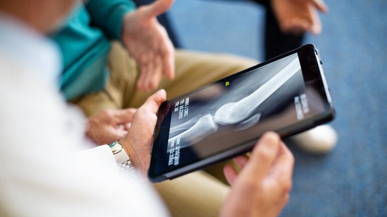 Präarthrose: Beginnende Arthrose