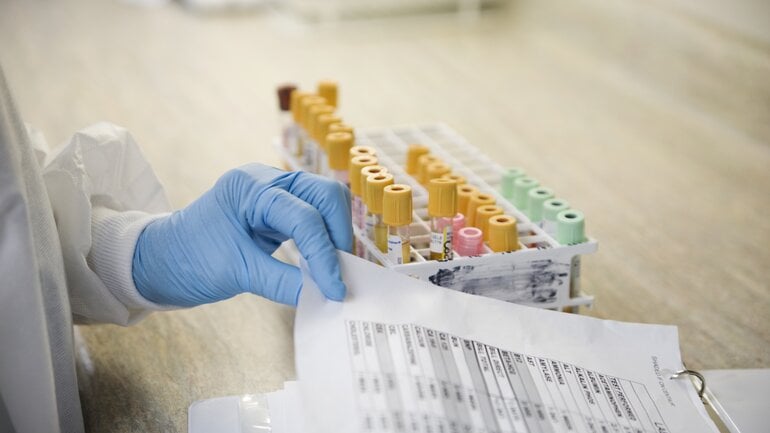 Trypsinogen: Blutwert der Bauchspeicheldrüse