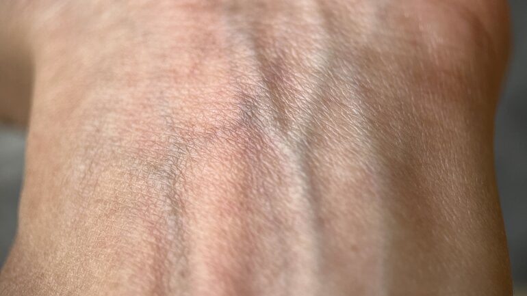 Warum wirken Adern überhaupt blau?