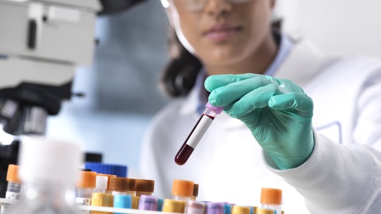 Gerinnungsstörung: Ursache von blauen Flecken ohne Grund