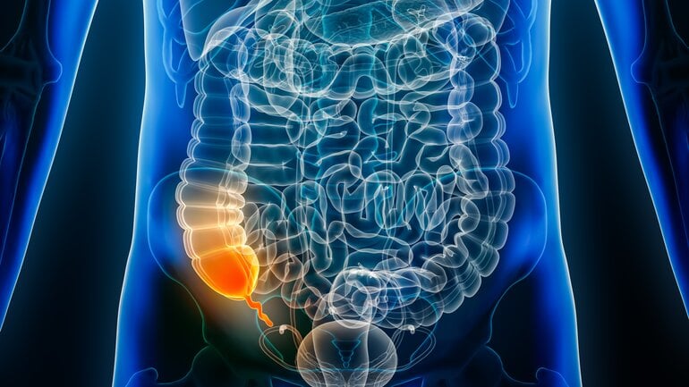 Wurmfortsatz: Wichtige Funktion für das Immunsystem