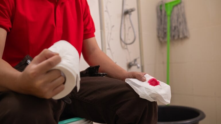 Analfissur: Hellrotes Blut im Stuhl