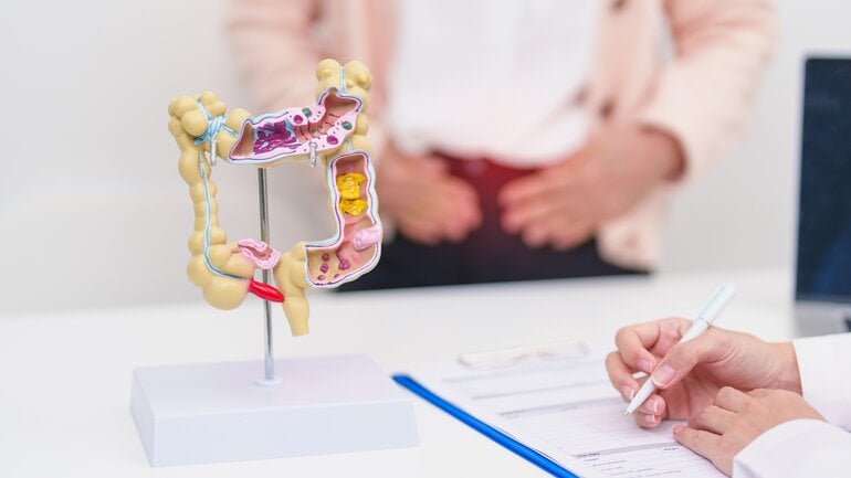 Blut im Stuhl: Divertikel als Ursache