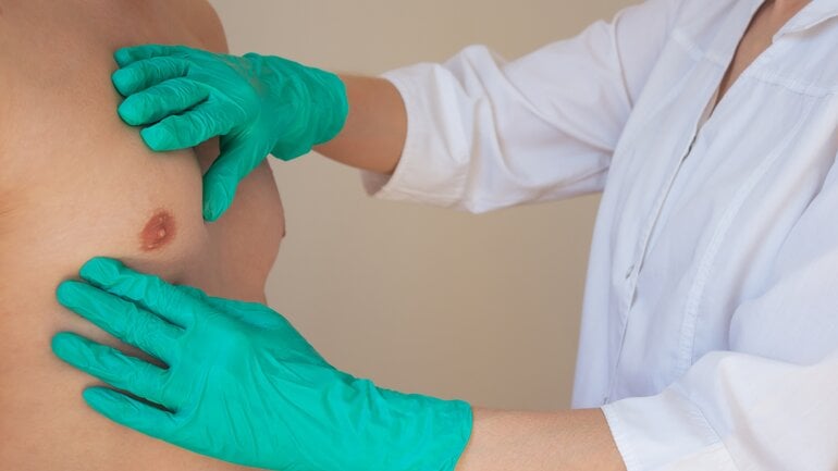 Eingezogene Brustwarze: Symptom für Brustkrebs bei Männern