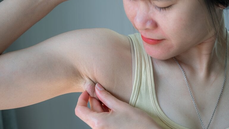 Chronische lymphatische Leukämie: Vergrößerte Lymphknoten