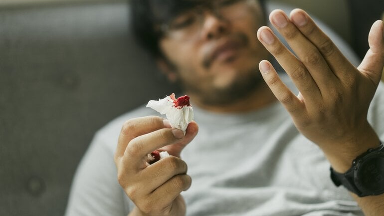 Symptom einer CML: Blutungsneigung