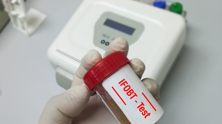 IFOBT-Test: Immunologischer Stuhltest zur Erkennung von Darmkrebs