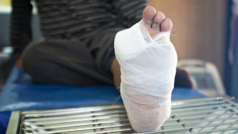 Diabetischer Fuß: Amputation als letzte Maßnahme
