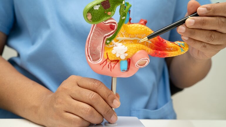 Fettstuhl: Häufige Ursache sind Probleme der Bauchspeicheldrüse