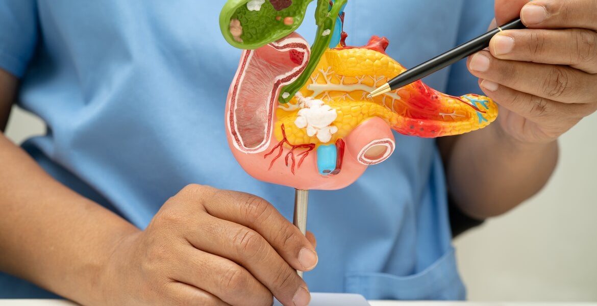 Arzt erklärt anhand eines Models, wieso Bauchspeicheldrüsenerkrankungen die Ursache von Fettstuhl sein können.