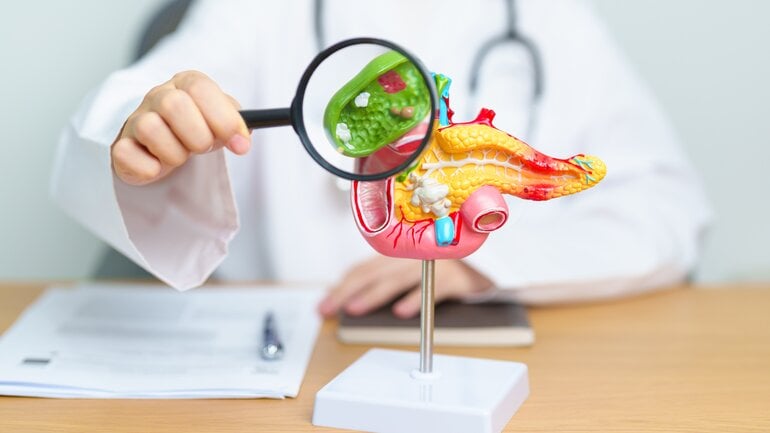 Gallenprobleme als Ursache von Fettstuhl